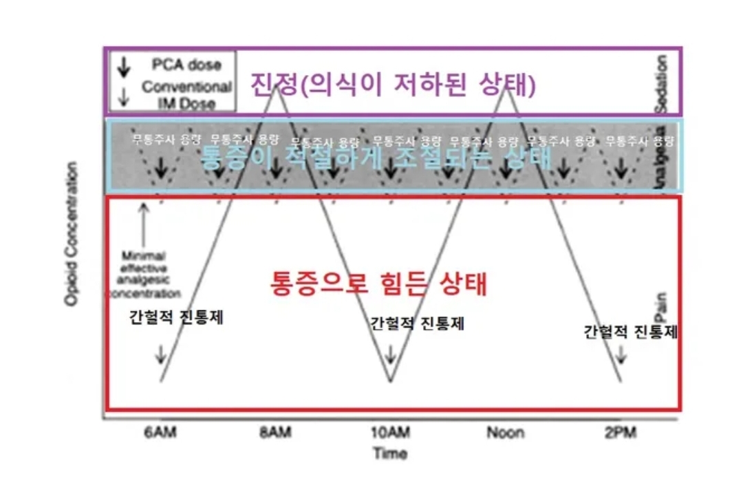 수술 후 통증조절! : PCA의 모든 것 1 - Screenshot_20230708_224152_Naver Blog.jpg - 1